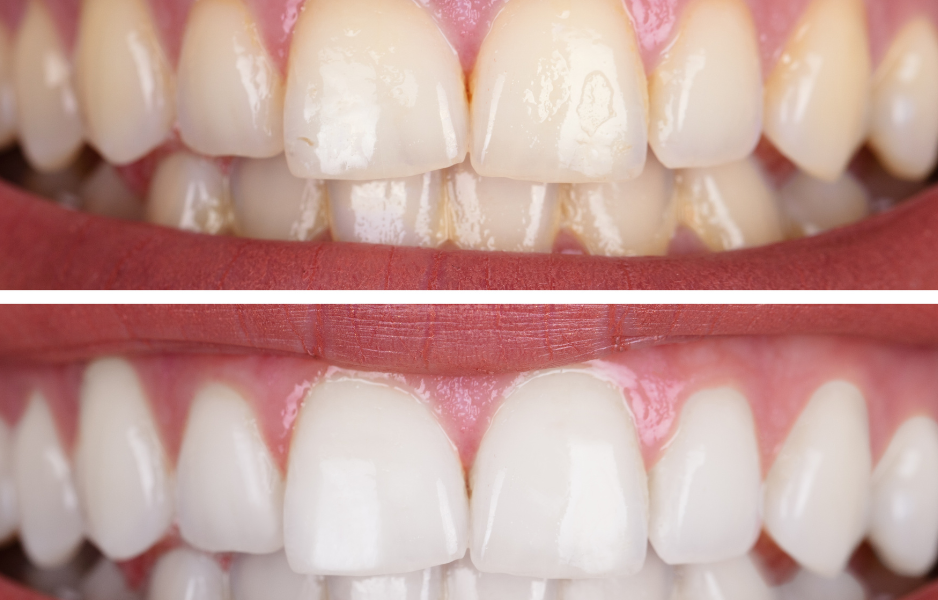 Untitled design (14)